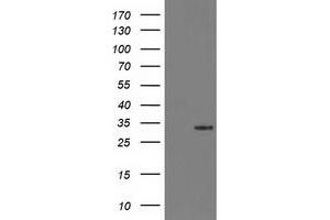 Western Blotting (WB) image for anti-Hydroxyprostaglandin Dehydrogenase 15-(NAD) (HPGD) antibody (ABIN1496363) (HPGD Antikörper)