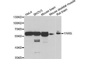 Western blot analysis of extracts of various cell lines, using YARS antibody (ABIN5974115) at 1/1000 dilution. (YARS Antikörper)