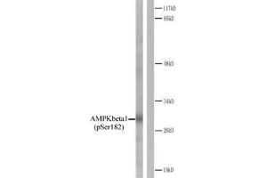 Western blot analysis of extracts from Jurkat cells. (PRKAB1 Antikörper  (pSer182))