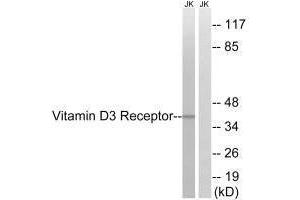 Western blot analysis of extracts from Jurkat cells, using Vitamin D3 Receptor (Ab-51) antibody. (Vitamin D Receptor Antikörper  (Ser51))