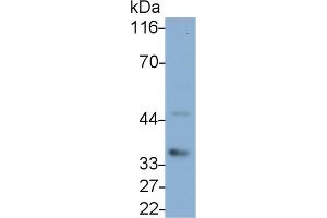 Detection of IL1b in Canine Pancreas lysate using Polyclonal Antibody to Interleukin 1 Beta (IL1b) (IL-1 beta Antikörper  (AA 103-260))