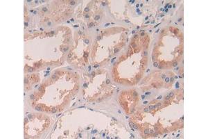 IHC-P analysis of Human Tissue, with DAB staining. (PIM3 Antikörper  (AA 1-326))