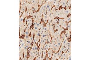 Immunohistochemistry (Paraffin-embedded Sections) (IHC (p)) image for anti-CD14 (CD14) (AA 54-83), (N-Term) antibody (ABIN390260)