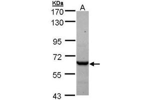 TCP1 epsilon Antibody staining of A431 (A) whole cell lysate (30 µg) at 1/1000 dilution, 7. (CCT5 Antikörper  (AA 1-224))