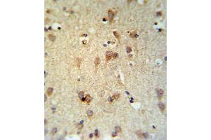 Immunohistochemistry (IHC) image for anti-Lecithin-Cholesterol Acyltransferase (LCAT) antibody (ABIN3004355) (LCAT Antikörper)