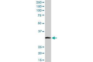 ITPK1 MaxPab rabbit polyclonal antibody. (ITPK1 Antikörper  (AA 1-314))