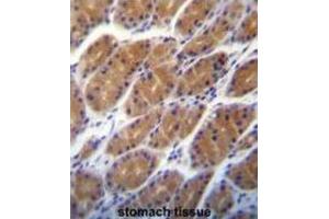 Immunohistochemistry (IHC) image for anti-Claudin 2 (CLDN2) antibody (ABIN2996860) (Claudin 2 Antikörper)