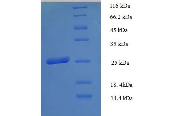 HLA-DPB1 Protein (AA 30-225, Extracellular) (His tag)