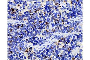 Immunohistochemistry analysis of paraffin-embedded mouse spleen using CD284 Monoclonal Antibody at dilution of 1:400. (TLR4 Antikörper)