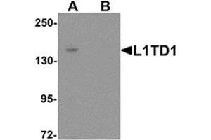 Western blot analysis of L1TD1 in Jurkat cell lysate with L1TD1 antibody at 1 ug/mL in (A) the absence and (B) the presence of blocking peptide. (L1TD1 Antikörper  (C-Term))