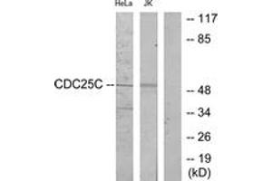 Western blot analysis of extracts from HeLa/Jurkat cells, using CDC25C (Ab-216) Antibody. (CDC25C Antikörper  (AA 183-232))