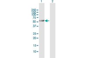 Western Blot analysis of ALDH6A1 expression in transfected 293T cell line by ALDH6A1 MaxPab polyclonal antibody. (ALDH6A1 Antikörper  (AA 1-535))