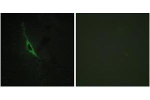 Immunofluorescence (IF) image for anti-Granzyme K (Granzyme 3, Tryptase II) (GZMK) (AA 61-110) antibody (ABIN2889995) (GZMK Antikörper  (AA 61-110))