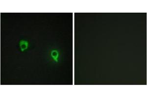 Immunofluorescence analysis of COS7 cells, using AKAP1 antibody. (AKAP1 Antikörper  (Internal Region))