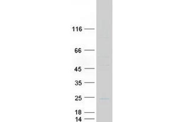 CRYGC Protein (Myc-DYKDDDDK Tag)