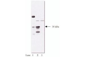 Western Blotting (WB) image for anti-HA-Tag antibody (Agarose Beads) (ABIN264383) (HA-Tag Antikörper  (Agarose Beads))