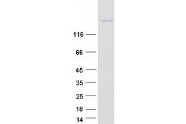 Tenascin R Protein (Myc-DYKDDDDK Tag)