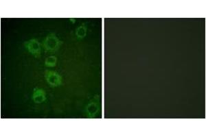 Immunofluorescence (IF) image for anti-Caspase 6, Apoptosis-Related Cysteine Peptidase (CASP6) (AA 223-272) antibody (ABIN2888590) (Caspase 6 Antikörper  (AA 223-272))