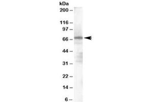 Western blot testing of human spleen lysate with PARP2 antibody at 1ug/ml. (PARP2 Antikörper)