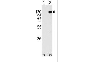 Western blot analysis of FGFR1 (arrow) using rabbit polyclonal FGFR1 Antibody  (R). (FGFR1 Antikörper  (AA 744-773))