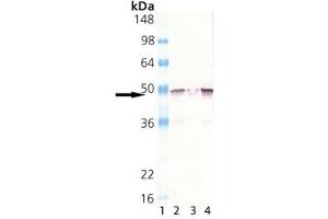 Western blot analysis of MEK1, pAb : Lane 1: MW marker, Lane 2: HeLa (heat shocked) , Lane 3: Rat spleen extract, Lane 4: Mouse brain extract (MEK1 Antikörper  (N-Term))