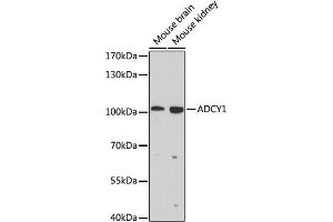 Western blot analysis of extracts of various cell lines, using  antibody (ABIN6129203, ABIN6136557, ABIN6136558 and ABIN6225082) at 1:1000 dilution. (ADCY1 Antikörper  (AA 470-610))