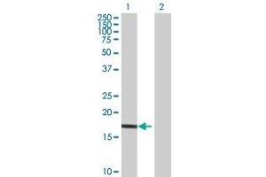 Lane 1: UBE2G1 transfected lysate ( 18. (UBE2G1 293T Cell Transient Overexpression Lysate(Denatured))