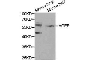 Western blot analysis of extracts of various tissues, using AGER antibody. (RAGE Antikörper  (AA 30-330))
