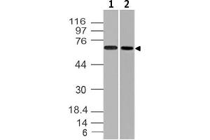Image no. 1 for anti-Endoglin (ENG) (AA 43-287) antibody (ABIN5027187) (Endoglin Antikörper  (AA 43-287))