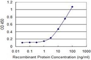 Detection limit for recombinant GST tagged HDAC6 is 0. (HDAC6 Antikörper  (AA 1-1063))