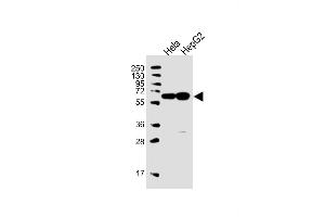 All lanes : Anti-UTP6 Antibody (N-term) at 1:1000 dilution Lane 1: Hela whole cell lysate Lane 2: HepG2 whole cell lysate Lysates/proteins at 20 μg per lane. (UTP6 Antikörper  (N-Term))