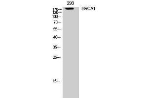 Western Blotting (WB) image for anti-Breast Cancer 1 (BRCA1) (Ser182) antibody (ABIN3183540) (BRCA1 Antikörper  (Ser182))