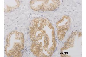 Immunohistochemistry (IHC) image for anti-Receptor-Interacting Serine-threonine Kinase 2 (RIPK2) (AA 431-540) antibody (ABIN522206)