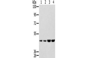 Western Blotting (WB) image for anti-Sjogren Syndrome Antigen B (SSB) antibody (ABIN2427328) (SSB Antikörper)