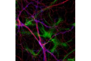 Immunocytochemistry (ICC) image for anti-Tubulin delta 2 (AA 443-449) antibody (ABIN1742551) (Tubulin delta 2 (AA 443-449) Antikörper)