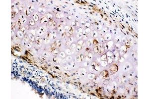 IHC-F testing of COL2A1 antibody and rat trachea tissue (COL2A1 Antikörper  (C-Term))