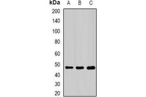 Western blot analysis of PIP4K2 beta expression in Hela (A), A549 (B), mouse spleen (C) whole cell lysates. (PIP4K2B Antikörper)