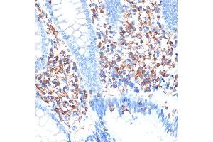 Immunohistochemistry of paraffin-embedded human appendix using ELMO1 Rabbit mAb (ABIN7266951) at dilution of 1:100 (40x lens). (ELMO1 Antikörper)