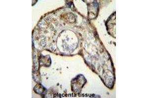 Immunohistochemistry (IHC) image for anti-Myeloid Cell Nuclear Differentiation Antigen (MNDA) antibody (ABIN2996101) (MNDA Antikörper)