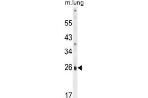 Western Blotting (WB) image for anti-PQ Loop Repeat Containing 1 (PQLC1) antibody (ABIN2995888) (PQLC1 Antikörper)