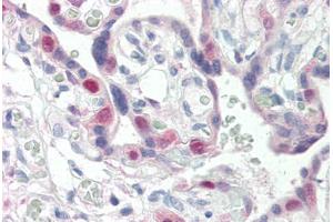 Human Placenta (formalin-fixed, paraffin-embedded) stained with CDK2 antibody ABIN337209 at 5 ug/ml followed by biotinylated anti-mouse IgG secondary antibody ABIN481714, alkaline phosphatase-streptavidin and chromogen. (CDK2 Antikörper)