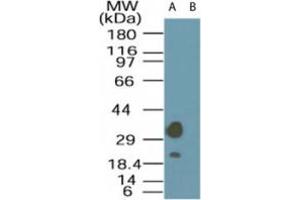 Image no. 1 for anti-STE20-Related Kinase Adaptor alpha (STRADA) (AA 300-350) antibody (ABIN200008) (STRADA Antikörper  (AA 300-350))