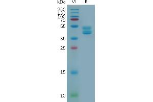 Human (1-38) Protein, hFc Tag on SDS-PAGE under reducing condition. (GPR77 Protein (AA 1-38) (Fc Tag))