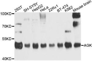 Western blot analysis of extracts of various cell lines, using AGK antibody (ABIN6003685) at 1/1000 dilution. (Acylglycerol Kinase Antikörper)