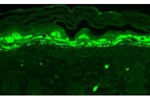 Immunohistochemistry of Mouse Anti-SHANK1 Antibody. (SHANK1 Antikörper  (Internal Region))