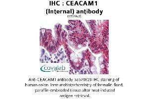 Image no. 1 for anti-Carcinoembryonic Antigen-Related Cell Adhesion Molecule 1 (CEACAM1) (Internal Region) antibody (ABIN1732947) (CEACAM1 Antikörper  (Internal Region))