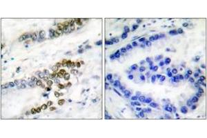 Immunohistochemistry (IHC) image for anti-Excision Repair Cross Complementing Polypeptide-1 (ERCC1) (AA 141-190) antibody (ABIN2889192) (ERCC1 Antikörper  (AA 141-190))