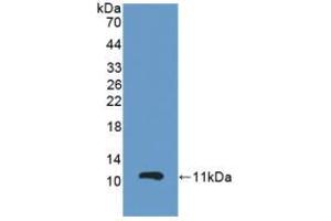 Figure. (GPX3 Antikörper  (AA 3-72))