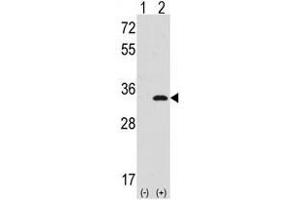 Image no. 2 for anti-Cyclin-Dependent Kinase 1 (CDK1) (N-Term) antibody (ABIN357035) (CDK1 Antikörper  (N-Term))