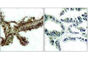 Image no. 1 for anti-V-Akt Murine Thymoma Viral Oncogene Homolog 1 (AKT1) (pThr308) antibody (ABIN196711) (AKT1 Antikörper  (pThr308))